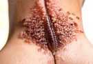 SKIN SIGNALS USED TO DIAGNOSE SERIOUS DISEASES